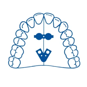 Fan Type Screw 2 Pieces S/Steel 14mm
