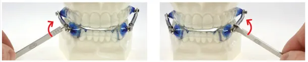 Anti Snoring Kit